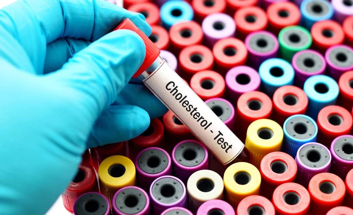 Cholesterol का खतरा आपकी थाली में छुपा है – पहचानें इन 5 घातक फूड्स को