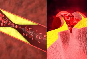 Blood Clotting
