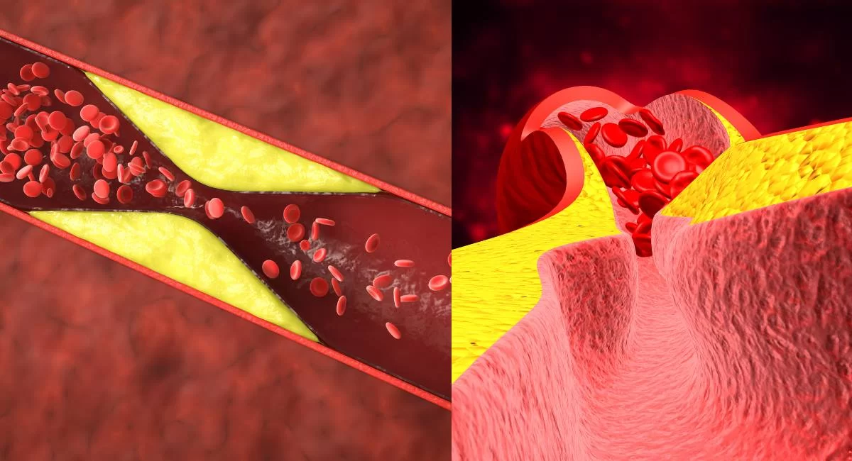 Blood Clotting