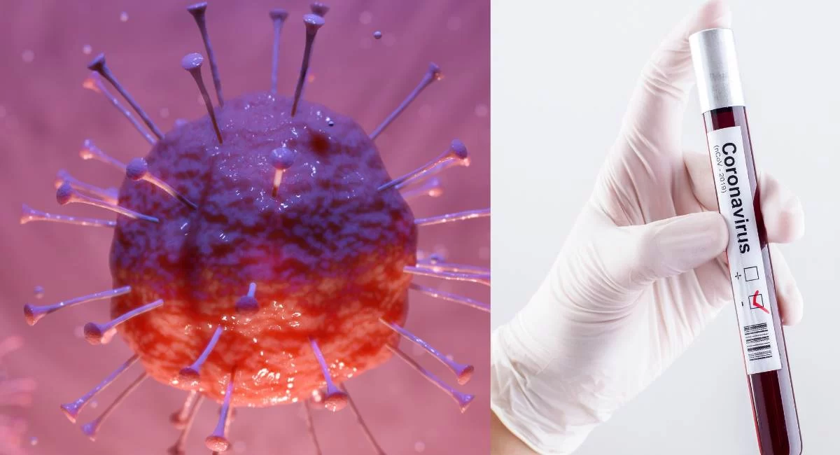 Coronavirus