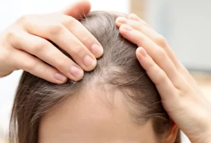 Hair Regrowth Tips