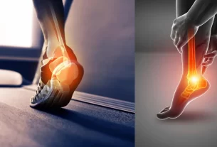 Heel Pain Relief