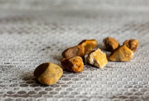 gallstone treatment