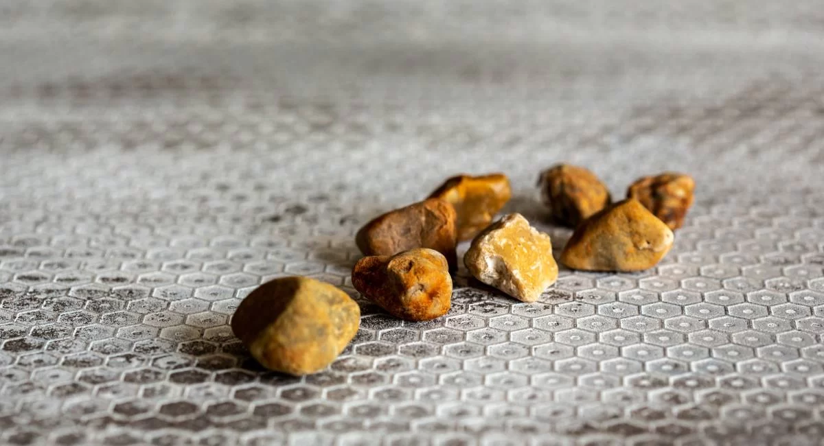 gallstone treatment