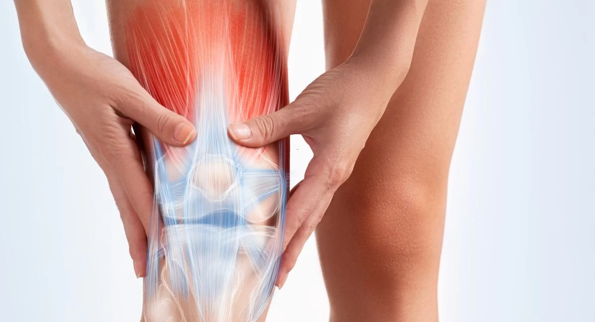 Arthritis treatment