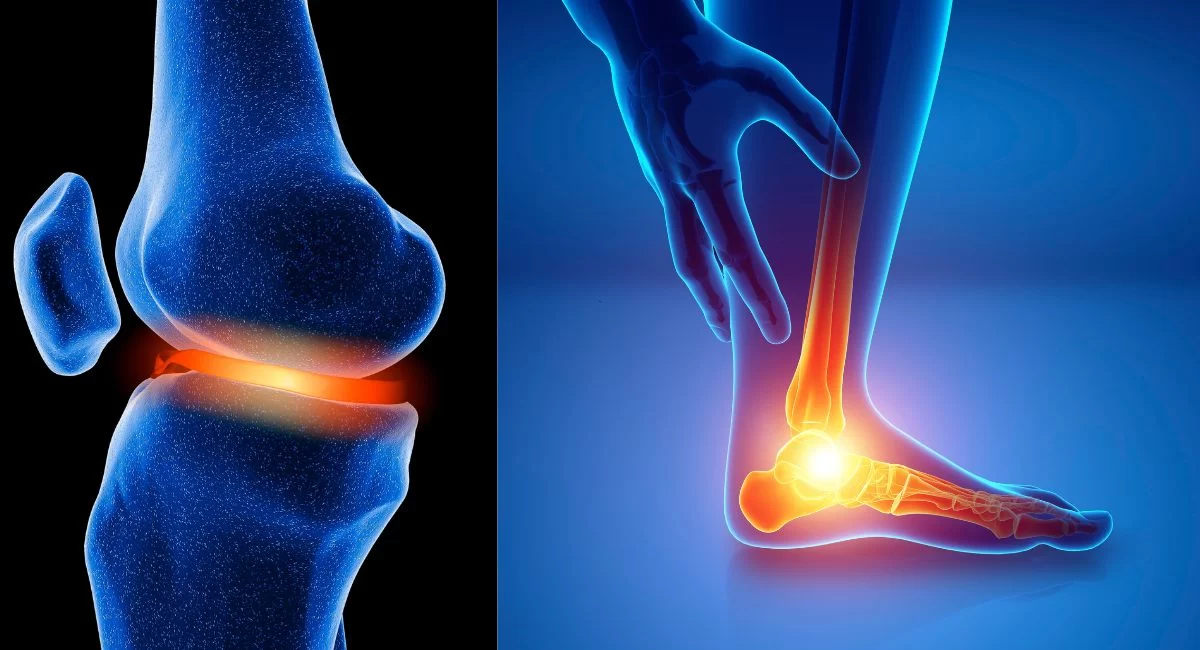 Bone Joint Pain