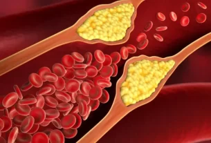Foods That Help Reduce Cholesterol Naturally