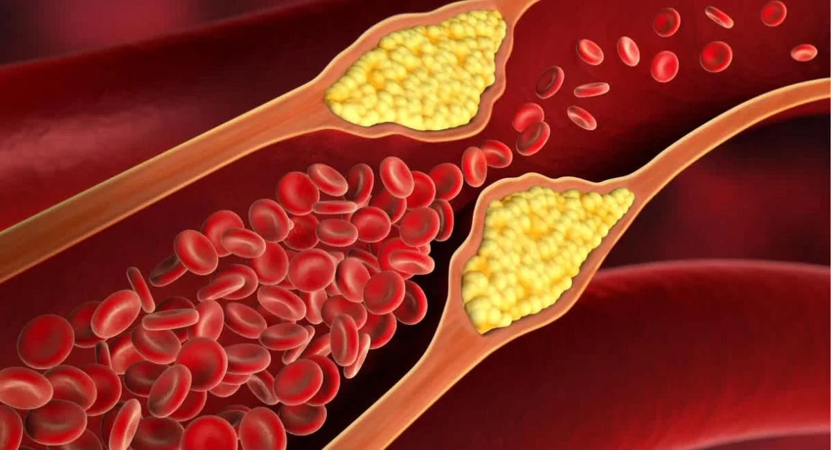 Foods That Help Reduce Cholesterol Naturally