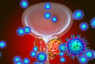 Prostate Cancer