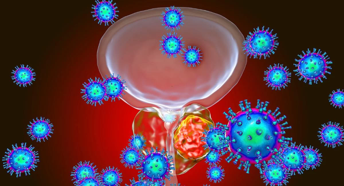 Prostate Cancer