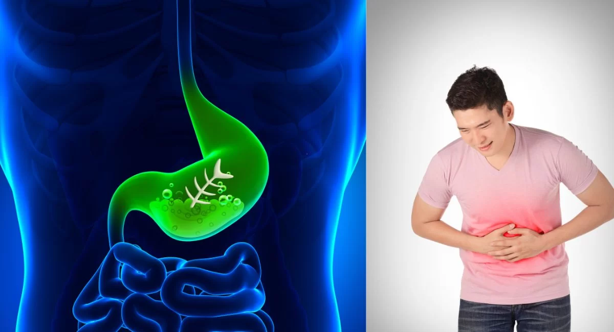 Stomach Gas Relief
