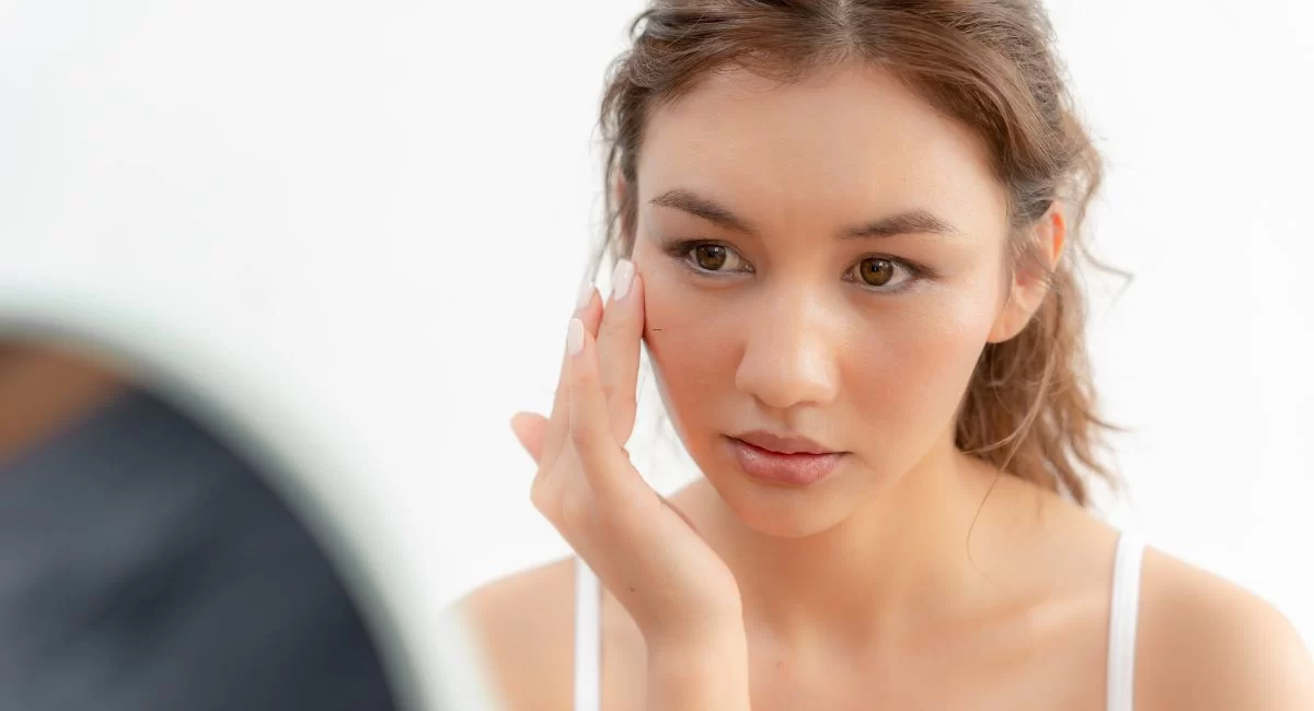 heat rash treatment