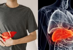 iron overload disease