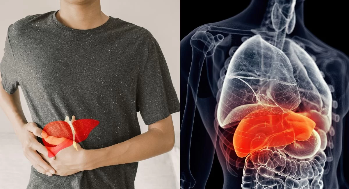 iron overload disease