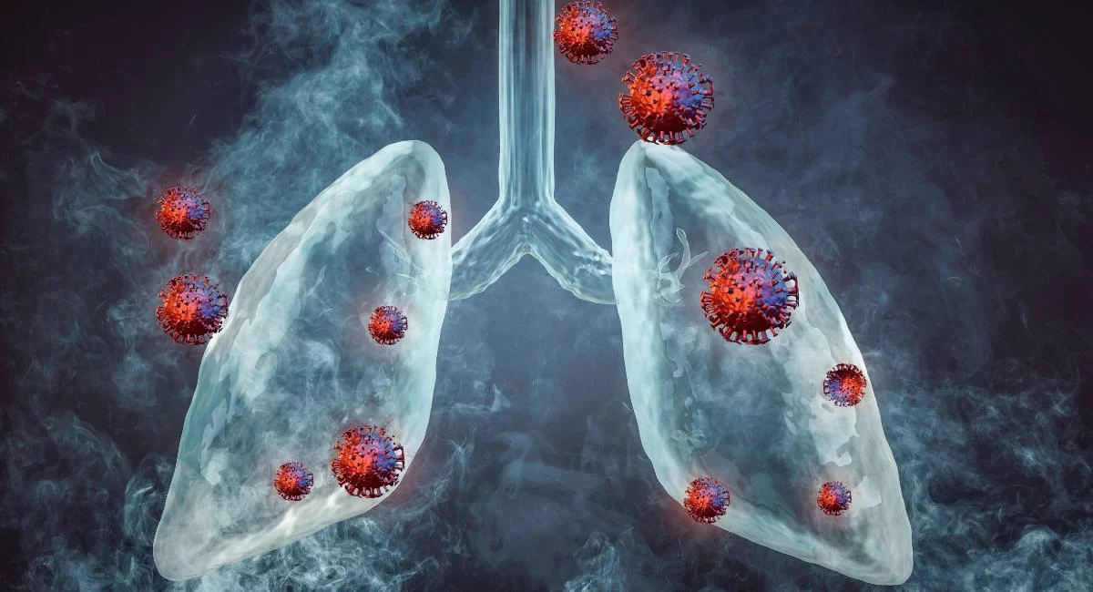 mRNA lung cancer vaccine